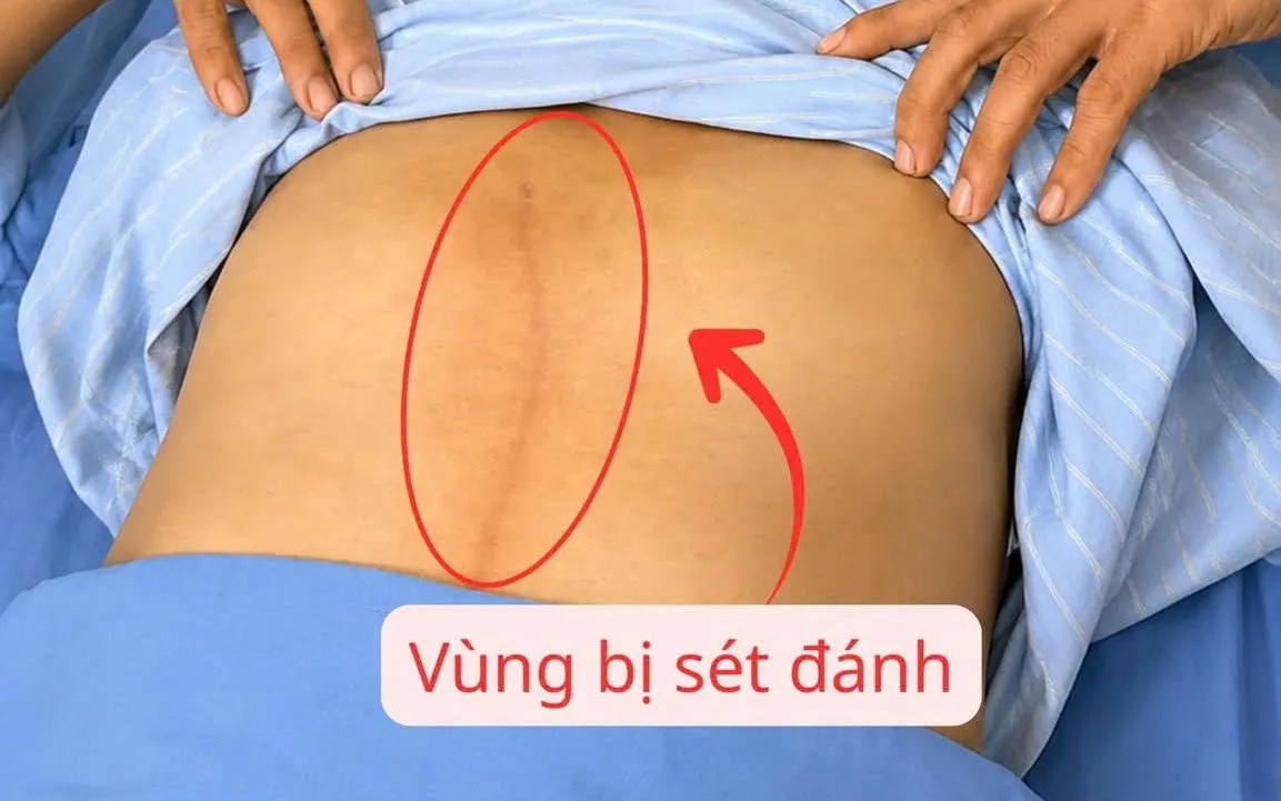 Ảnh: Sở Y tế Phú Thọ