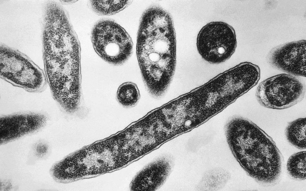 Hình ảnh vi khuẩn Legionella pneumophila, tác nhân gây ra bệnh viêm phổi Legionnaires - chụp bằng kính hiển vi điện tử năm 1978 (Ảnh: AP)