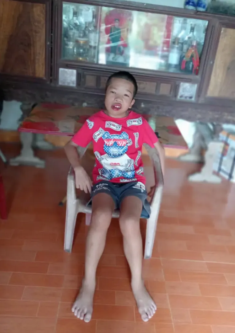 Th&ecirc;m một v&ograve;ng tay, th&ecirc;m một cơ hội cho cậu b&eacute; 13 tuổi ở Ninh B&igrave;nh - Ảnh 2.