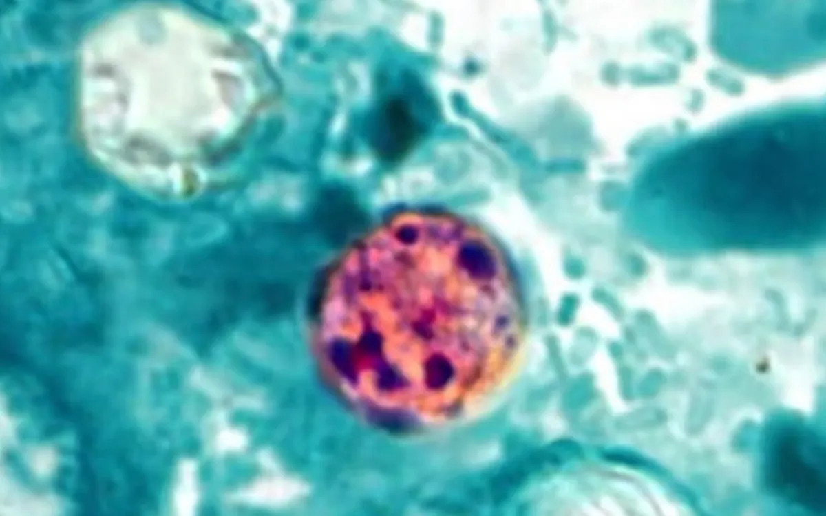 Cyclospora cayetanensis là một loại ký sinh trùng đơn bào gây ra bệnh nhiễm trùng đường ruột gọi là bệnh cyclosporiasis. Ảnh: CDC