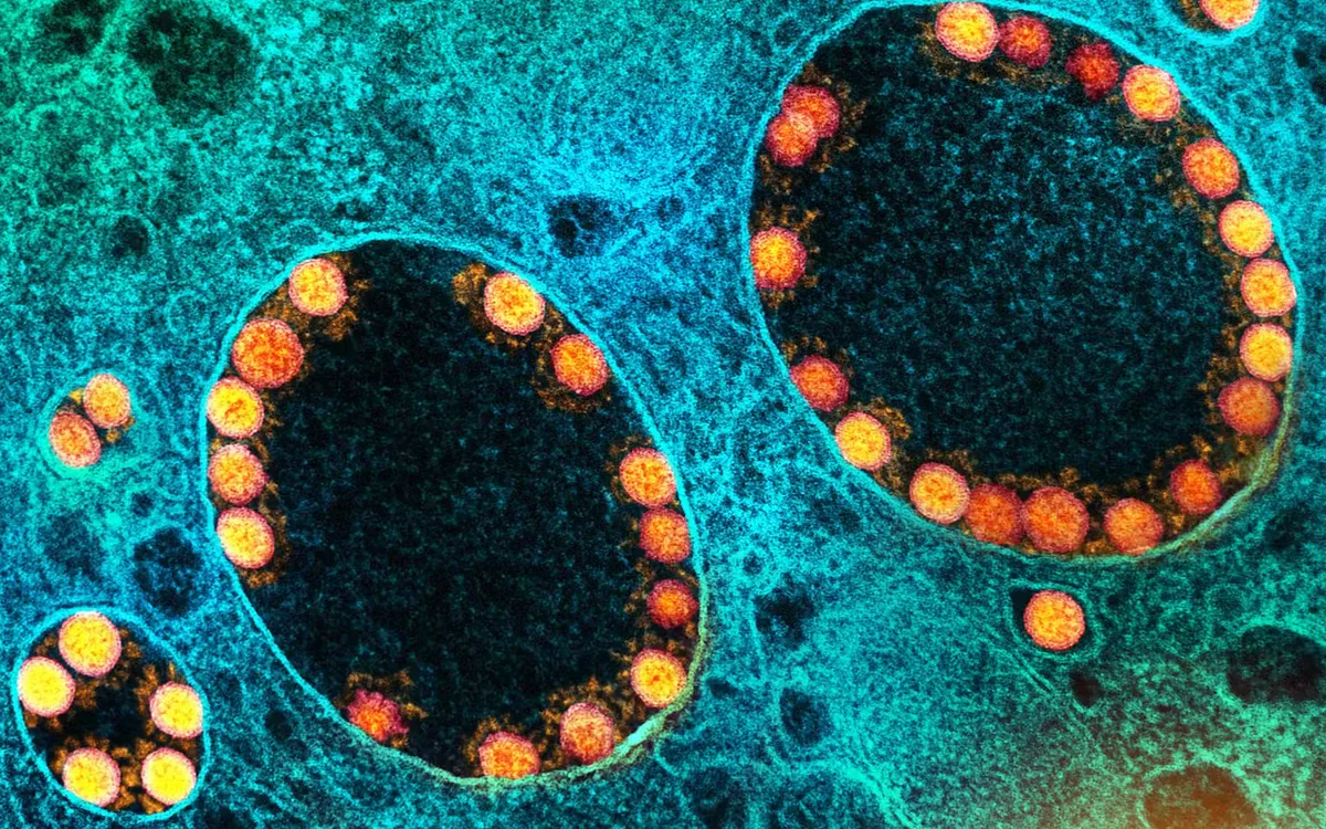 Do virus gây COVID-19 (màu vàng) và các loại virus RNA khác xâm nhập vào tế bào thông qua thể nội bào (endosome), nên các tạp chất trong vaccine mRNA có thể kích hoạt những phản ứng miễn dịch tương tự. (Ảnh minh họa: NIAID/Flickr)