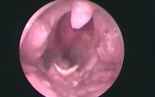 Ảnh: Bệnh viện Nhân dân 115
