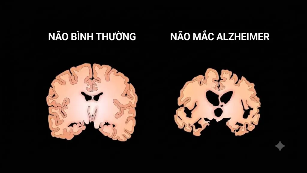 MRI có thể phát hiện sớm những dấu hiệu của Alzheimer- Ảnh 1.