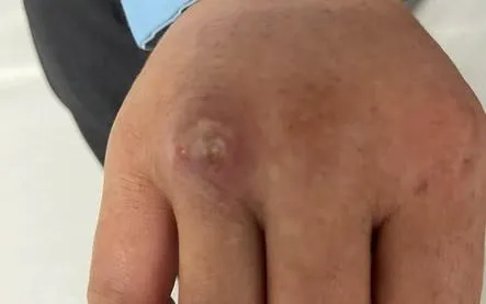 Ảnh: CDC Thanh Hóa
