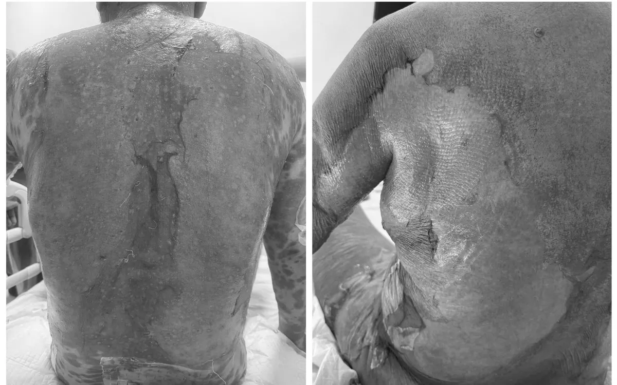 Ảnh: Bệnh viện Trung ương Quân đội 108