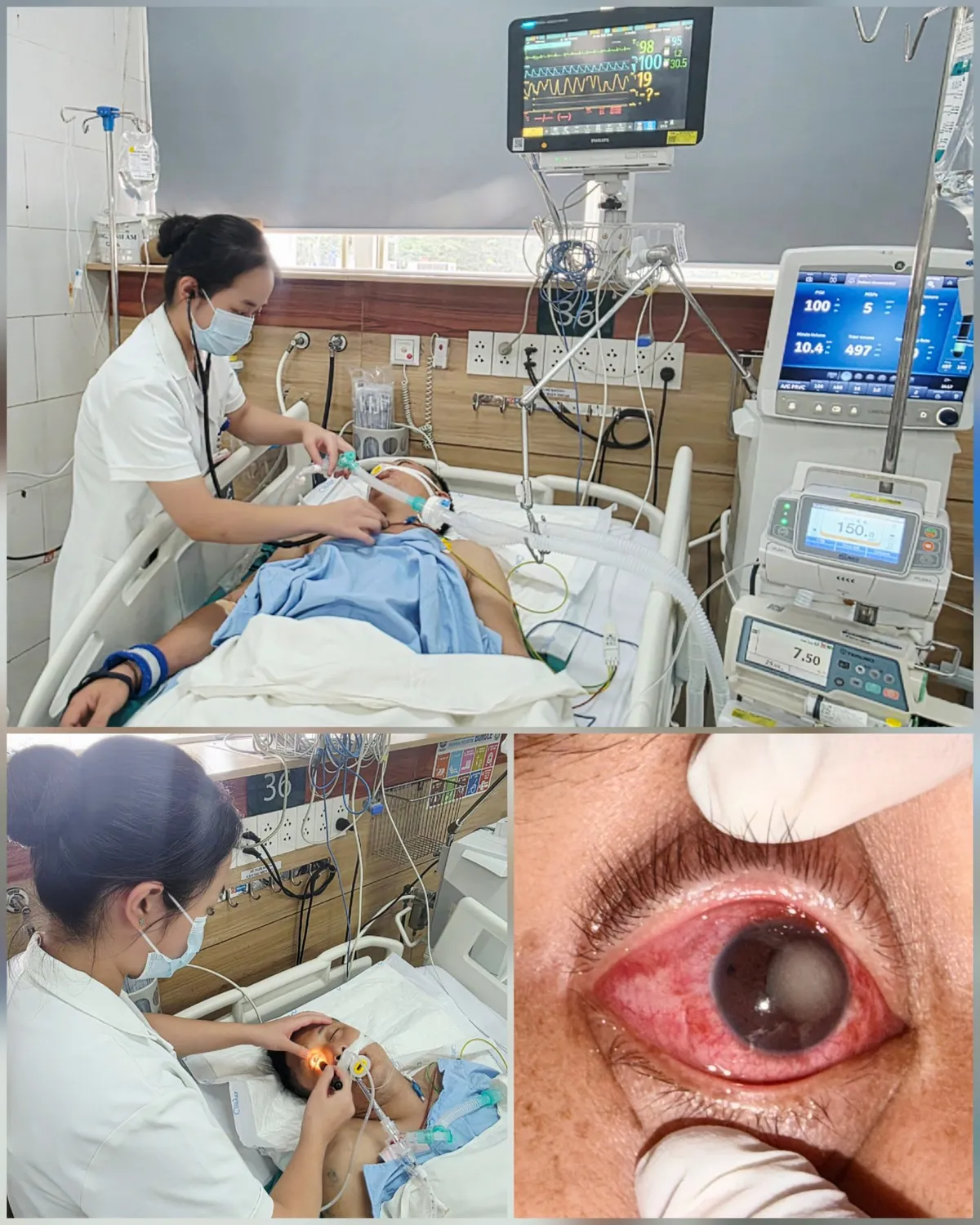 Bệnh viện Bạch Mai hội chẩn khẩn cấp cứu 7 nạn nhân ngộ độc khí clo- Ảnh 1. Bệnh viện Bạch Mai hội chẩn khẩn cấp cứu 7 nạn nhân ngộ độc khí clo- Ảnh 1.
