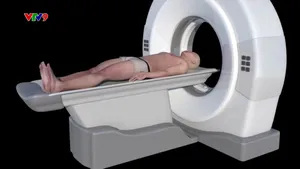 Bệnh viện Nhân dân 115 ứng dụng A.I cứu sống nhiều bệnh nhân đột quỵ