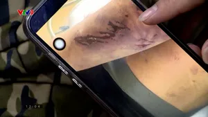 Thủ đoạn che giấu hành vi bạo hành của trung tâm công tác xã hội Hải Hà