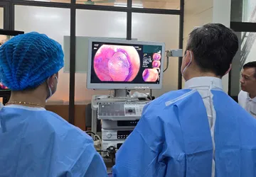 Ung Thư Đại Trực Tràng: Nỗi Lo Cho Thế Hệ Trẻ Và Bí Quyết Phòng Ngừa