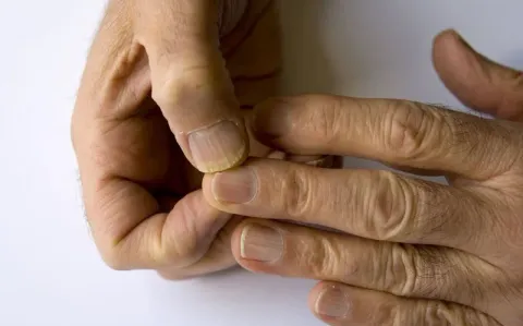Móng tay có thể tiết lộ tốc độ lão hóa của cơ thể