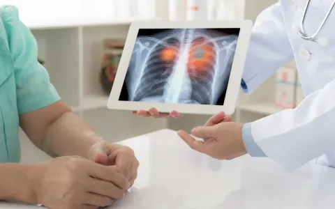 9 biện pháp giảm nguy cơ mắc ung thư