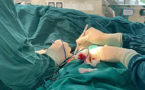 Áp xe vú - Mối lo ngại của các bà mẹ sau sinh