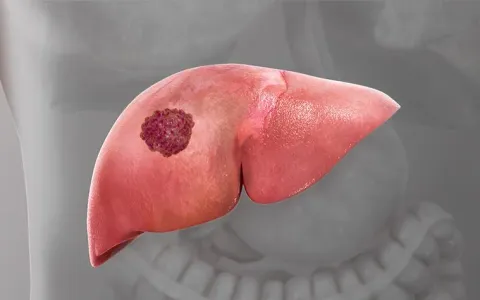 Phát hiện hợp chất tự nhiên có khả năng ức chế sự phát triển của ung thư gan