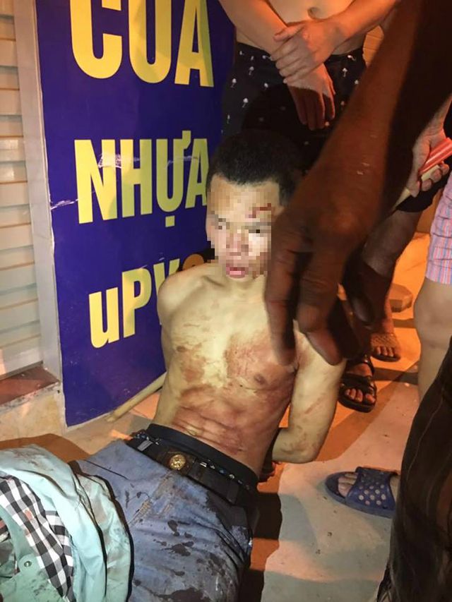 Hà Nội: Bắt tại trận tên cướp dùng dao cứa cổ tài xế taxi trong đêm - Ảnh 2.