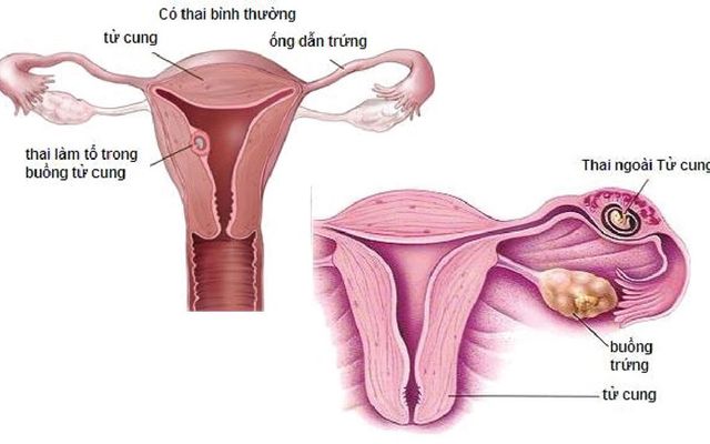 Tác dụng bất ngờ từ hoa chuối - Ảnh 3.