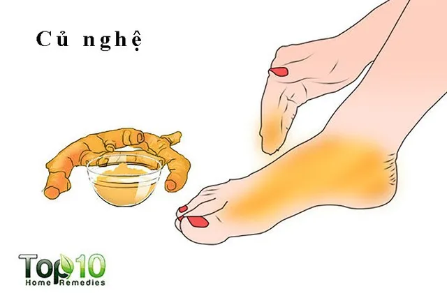 Mẹo nhỏ giảm đau nhanh nhất khi ngón chân cái bị sưng tấy - Ảnh 5.