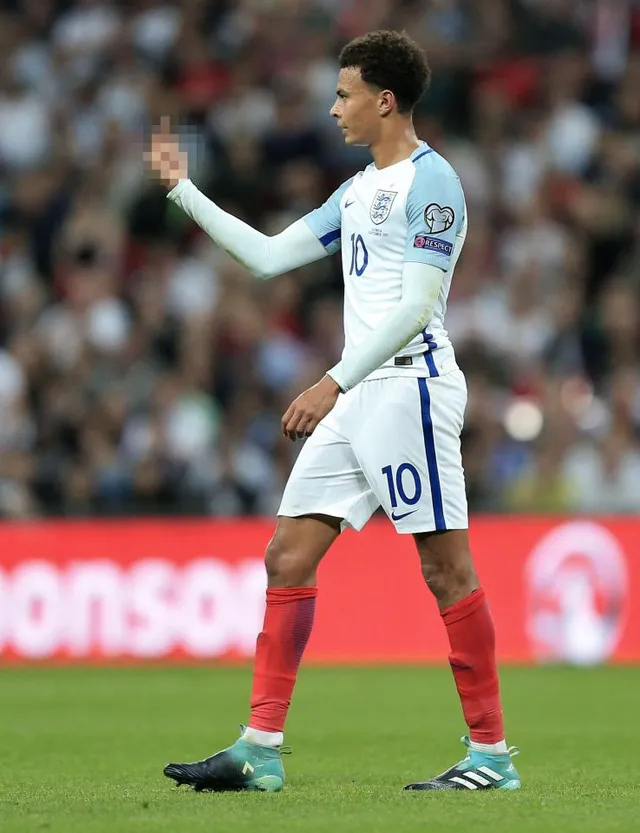 Dele Alli phân bua về ngón tay thối tại Wembley - Ảnh 1.