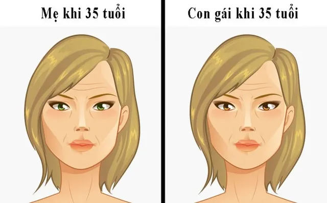 10 căn bệnh có nguy cơ lây truyền từ mẹ sang con gái - Ảnh 3. 10 căn bệnh có nguy cơ lây truyền từ mẹ sang con gái - Ảnh 3.