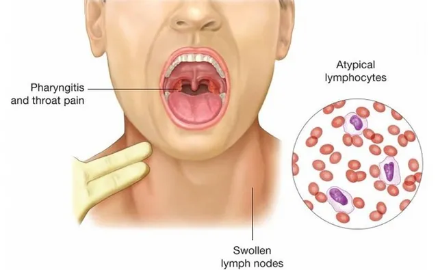 Đây chính là những lý do khiến cổ họng bị khô - Ảnh 3.