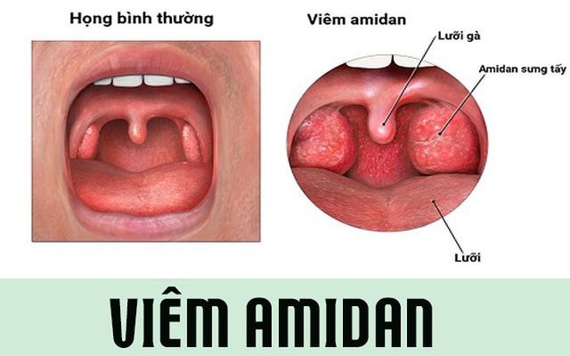 Đây chính là những lý do khiến cổ họng bị khô - Ảnh 8.