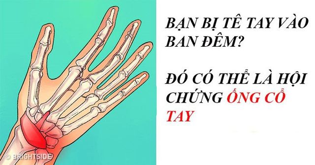 Lý do bàn tay bị tê vào ban đêm và làm thế nào để ngăn chặn nó? - Ảnh 1.