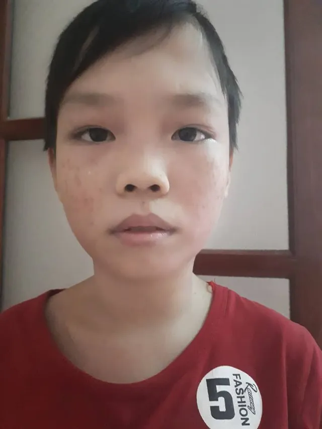 Cậu bé 15 tuổi bị bệnh tan máu bẩm sinh, viêm gan C cần được giúp đỡ - Ảnh 1.