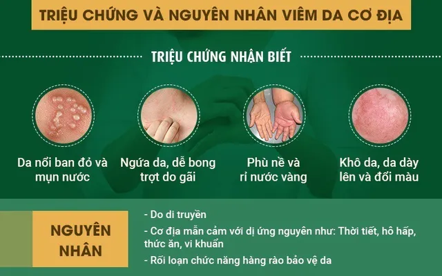 Bệnh viêm da cơ địa: Dấu hiệu và cách chữa từ tinh hoa y học cổ truyền - Ảnh 1.