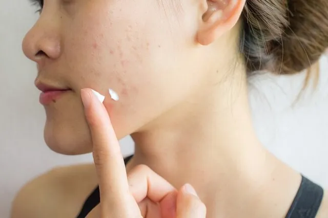 Những sản phẩm chăm sóc da không hiệu quả - Ảnh 5. Những sản phẩm chăm sóc da không hiệu quả - Ảnh 5.