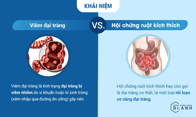 Viêm đại tràng và hội chứng ruột kích thích: Đừng nhầm lẫn nếu chưa hiểu rõ! - Ảnh 1.