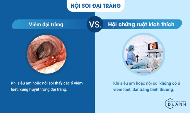 Viêm đại tràng và hội chứng ruột kích thích: Đừng nhầm lẫn nếu chưa hiểu rõ! - Ảnh 2.