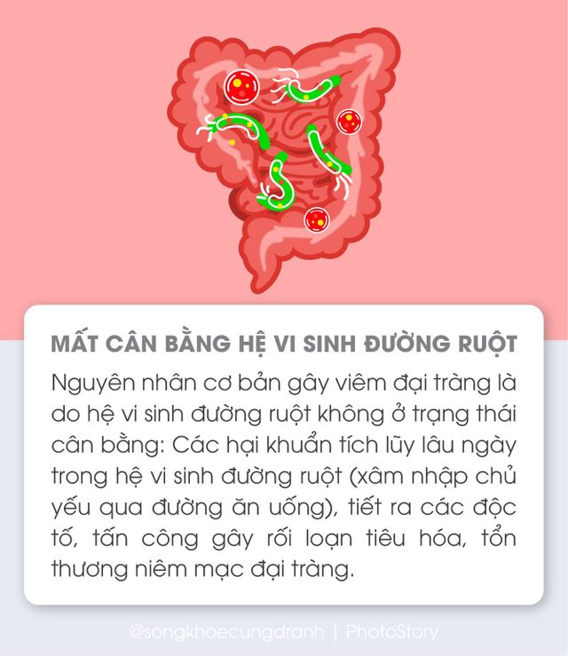 5 nguyên nhân phổ biến gây viêm đại tràng - Ảnh 1.