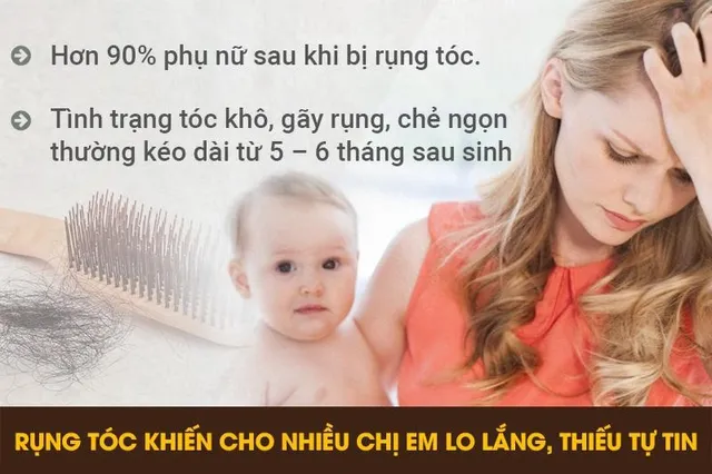 Cách chữa rụng tóc sau sinh mẹ nào cũng nên biết kẻo chồng chê - Ảnh 1.