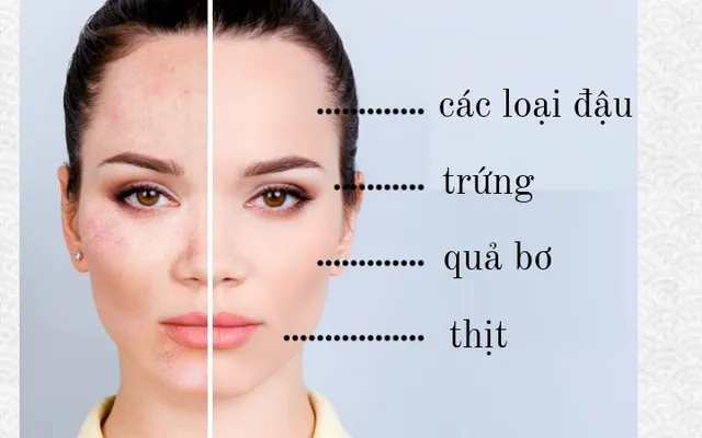 Tìm hiểu chế độ ăn cho từng loại da - Ảnh 3.