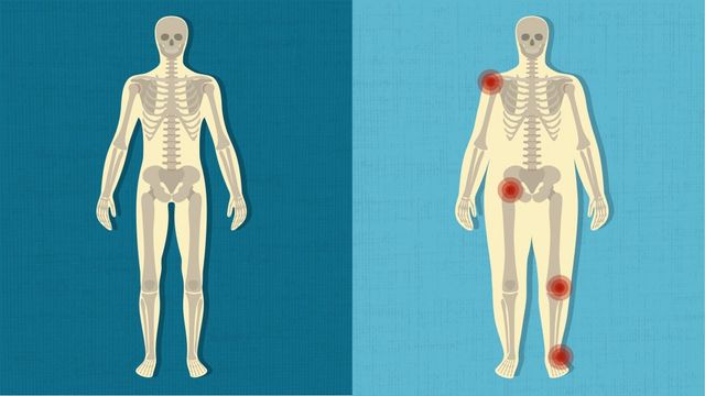 5 hiểm họa về tính mạng mà người trung niên phải đối mặt nếu béo phì - Ảnh 4.