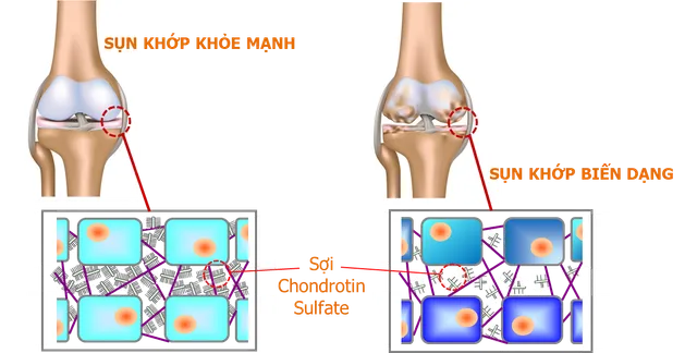 Chondro Support - Sản phẩm hỗ trợ sụn khớp của người Nhật - Ảnh 2.