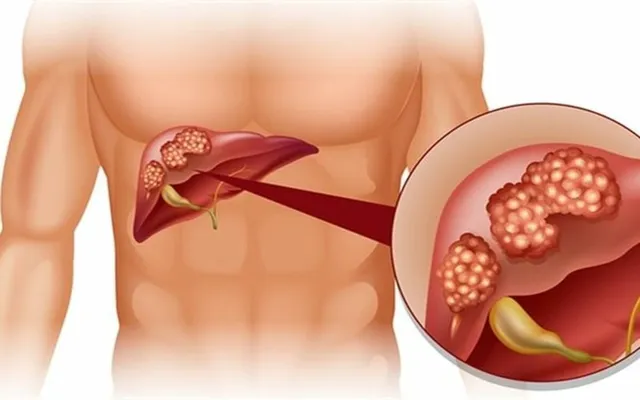 Những lý do nên “từ chối” thức ăn nhanh - Ảnh 5.