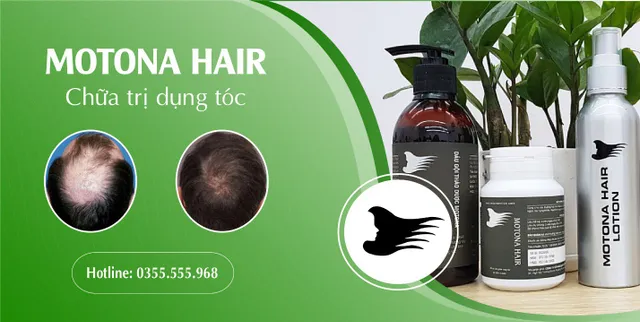 5 lý do nên chọn dầu gội thảo dược Motona Hair - Ảnh 4.