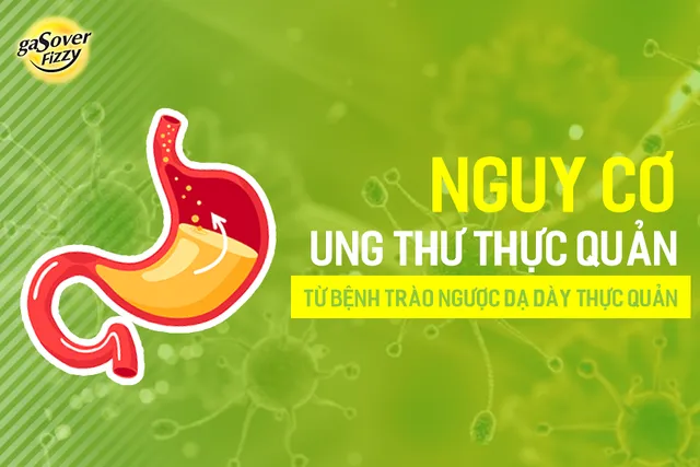 Trào ngược dạ dày có thể dẫn đến ung thư thực quản – GasOver Fizzy từ hôm nay! - Ảnh 2.