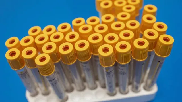 Singapore bắt đầu thử nghiệm giai đoạn cuối kháng thể chống virus SARS-CoV-2 - Ảnh 1. Singapore bắt đầu thử nghiệm giai đoạn cuối kháng thể chống virus SARS-CoV-2 - Ảnh 1.