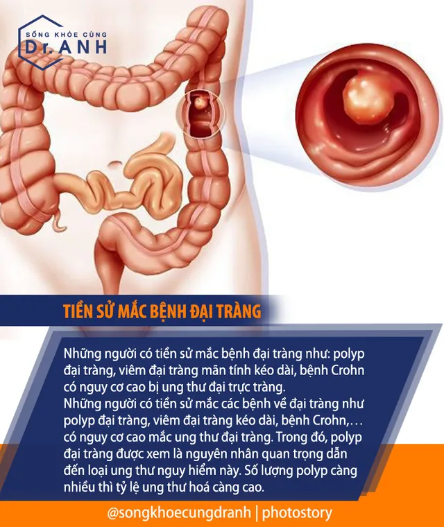 Nhận diện 6 tác nhân làm tăng nguy cơ ung thư đại trực tràng - Ảnh 1.