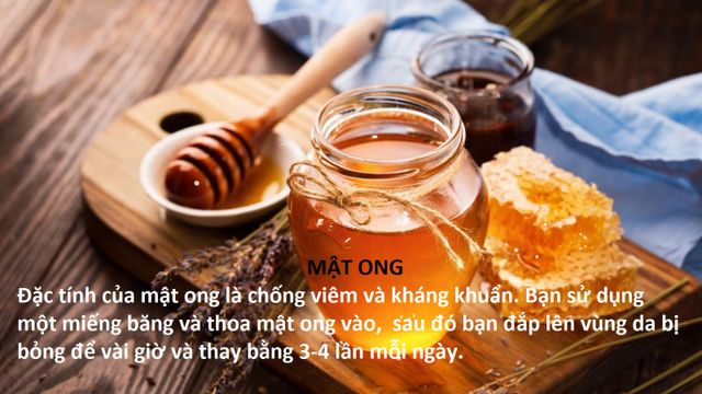 10 mẹo chữa bỏng tại nhà hiệu quả - Ảnh 5.