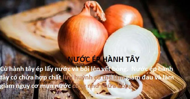 10 mẹo chữa bỏng tại nhà hiệu quả - Ảnh 8.