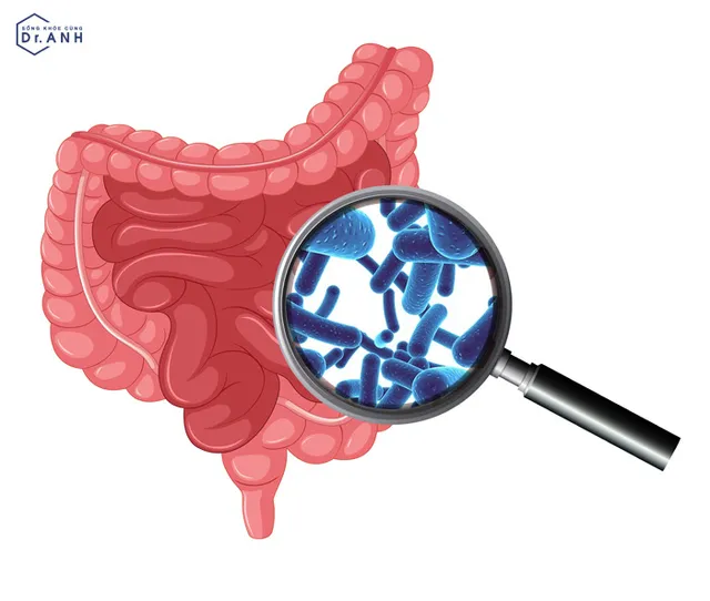 Loạn khuẩn đường ruột: Nguyên nhân, dấu hiệu và cách xử lý mà ai cũng cần biết - Ảnh 4.