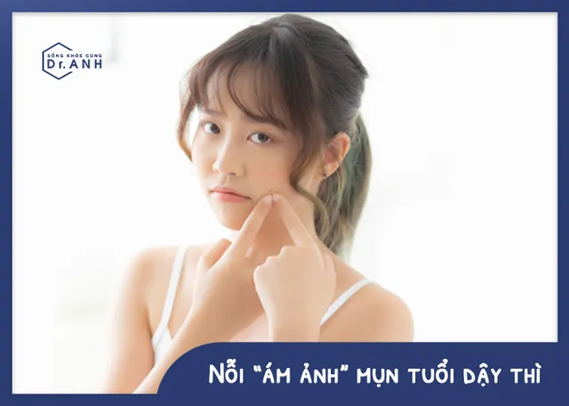 Đối tượng nào dễ bị mụn “tấn công”? - Ảnh 1.