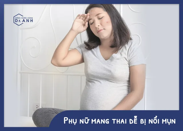 Đối tượng nào dễ bị mụn “tấn công”? - Ảnh 2.