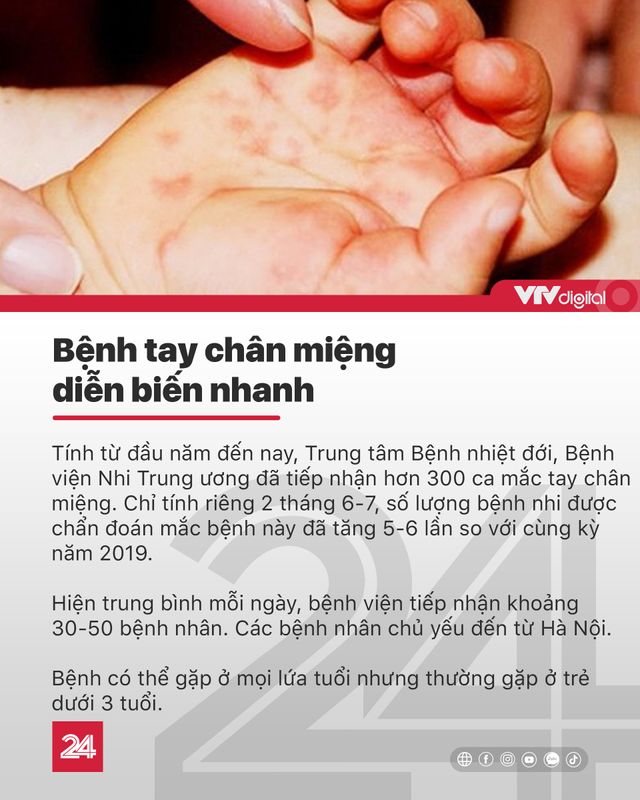 Tin nóng đầu ngày 15/7: Số ca tay chân miệng tăng nhanh, bắt đầu ca mổ tách dính song sinh hiếm gặp - Ảnh 3.