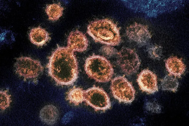 Phát hiện biến thể của virus SARS-CoV-2 gây triệu chứng nhẹ hơn tại Singapore - Ảnh 1.