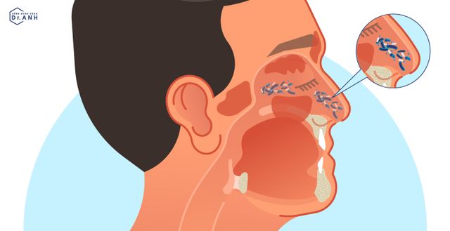 4 lợi ích bất ngờ của bào tử lợi khuẩn với sức khỏe đường hô hấp - Ảnh 2.