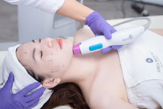 Công nghệ trẻ hóa xóa nhăn hàng đầu Hoa Kỳ Thermage FLX tại Amia Beauty Center - Ảnh 1.