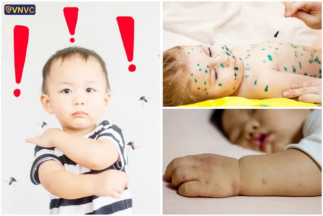 Tư vấn trực tuyến: Vaccine và dinh dưỡng phòng chống bệnh mùa thu đông cho trẻ em và người lớn - Ảnh 2.